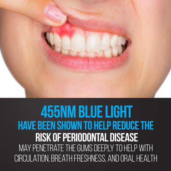 Teeth and Gums Periodontal Care, Blue Light Therapy Gum Disease Light, Oral Care, 16 LED Blue Light Therapy May Help Reduce Tooth Pain Quickly | May Help with issues from Reduce Receding Gums & Toothache