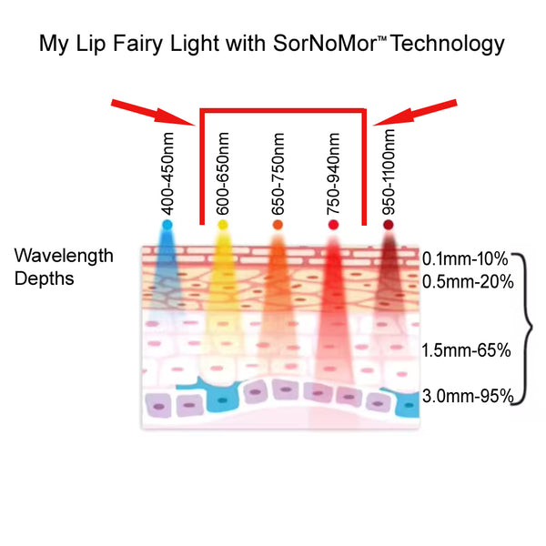 SorNoMor Red Light Lip Therapy for Cold Sores, Infrared Light Therapy & Red Light Lip Plumper.